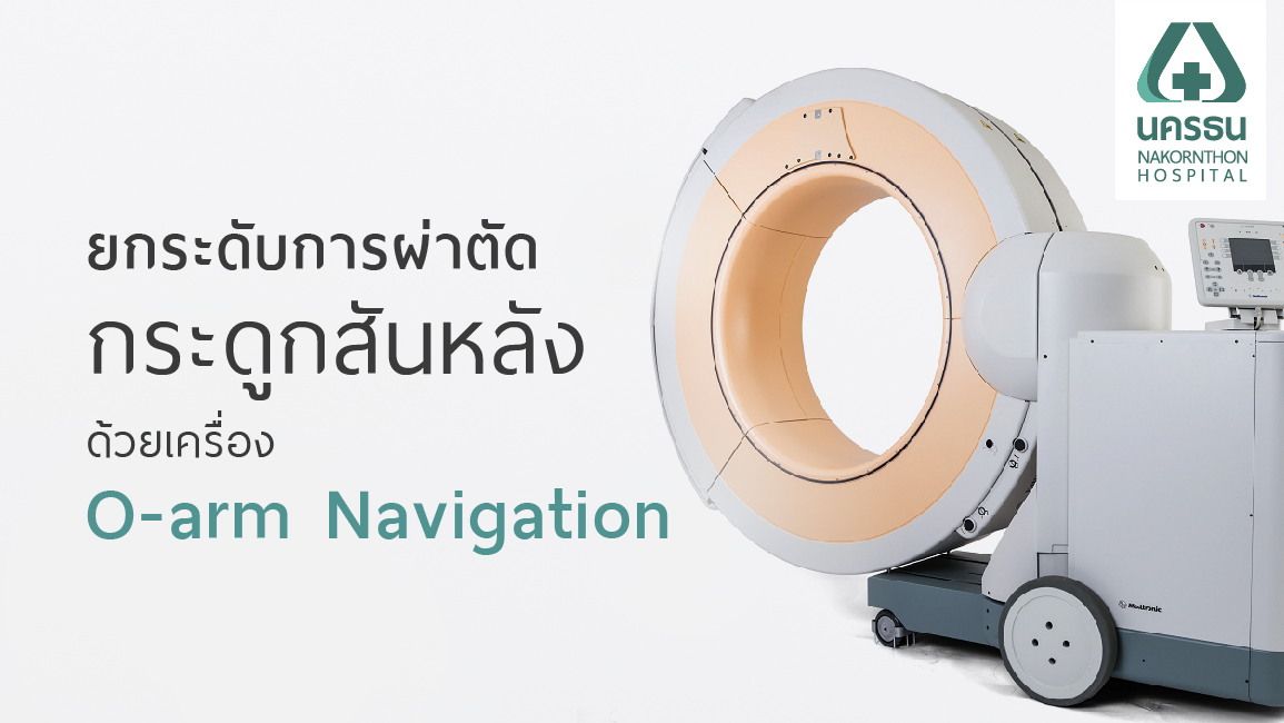 เทคโนโลยี O-arm Navigation เปลี่ยนการผ่าตัดกระดูกสันหลังให้เป็นเรื่องง่าย